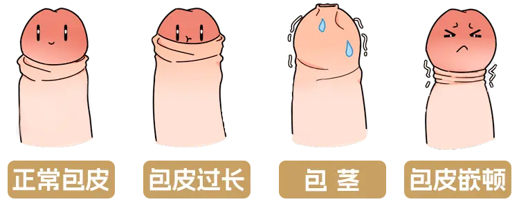 包皮系带过短危害有哪些？